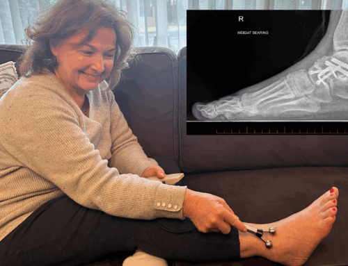 Reference – Colleen – Post Op Reco and Rehab